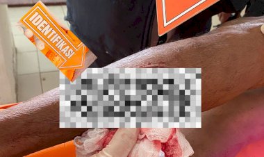Kasat Reskrim : Warga Suelain Ditemukan Meninggal Dengan Luka Sayat Benda Tajam, Kami Lakukan Penyelidikan