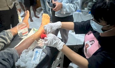 Motor Vs Motor, Salah Satu Pengendara Alami Luka dan Patah Kaki Kiri