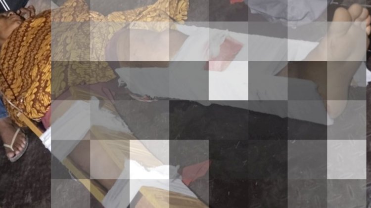 Lakalantas di Dodaek Satu Orang Patah  Kaki dan Dua Lainnya Luka Luka